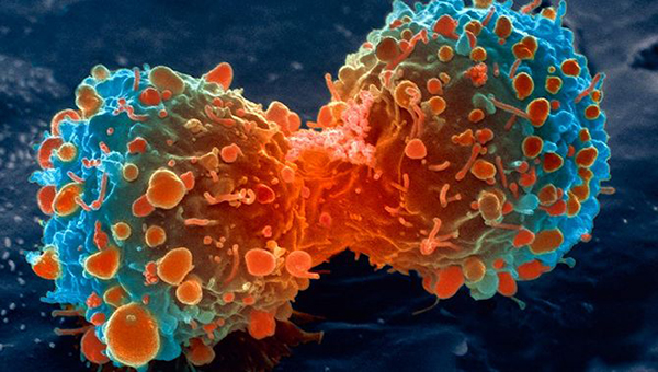 lung-cancer-cell-dividing-article.__v600248237